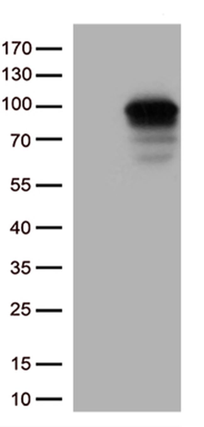 DDX4 Antibody in Western Blot (WB)