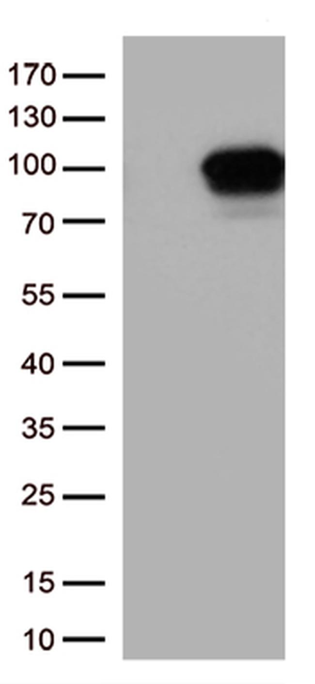 DDX4 Antibody in Western Blot (WB)
