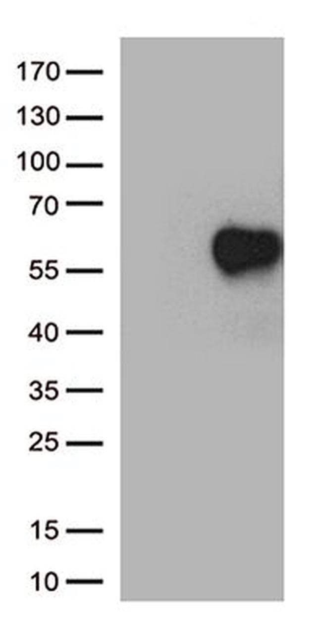 IL2RA Antibody in Western Blot (WB)