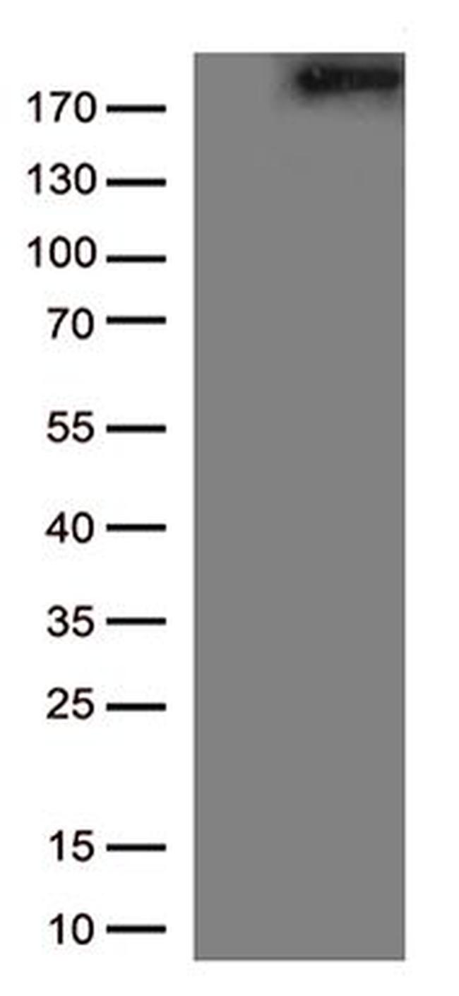 MAP2 Antibody in Western Blot (WB)