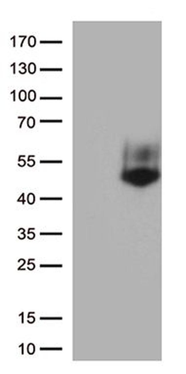 FCGR3A Antibody in Western Blot (WB)