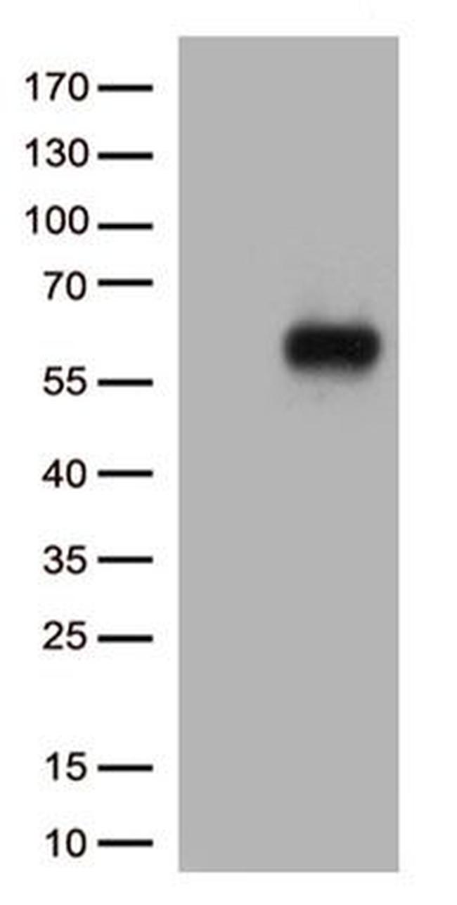 IL3RA Antibody in Western Blot (WB)