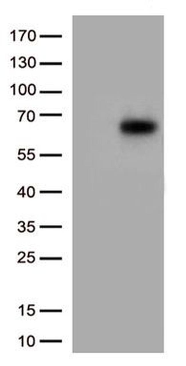 IL3RA Antibody in Western Blot (WB)