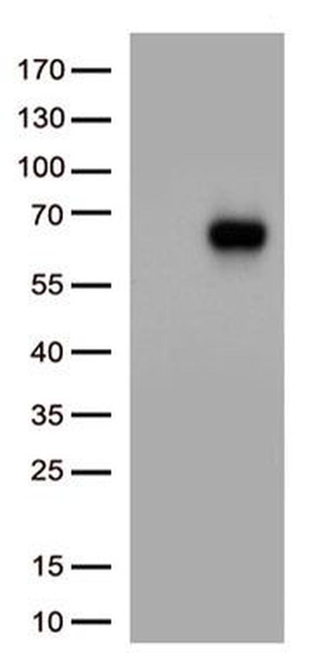 IL3RA Antibody in Western Blot (WB)