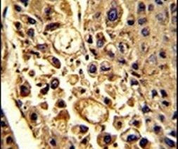 CFHR1 Antibody in Immunohistochemistry (IHC)