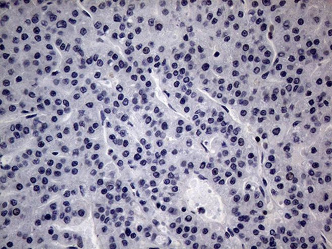 CFI Antibody in Immunohistochemistry (Paraffin) (IHC (P))