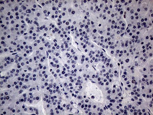 CFI Antibody in Immunohistochemistry (Paraffin) (IHC (P))