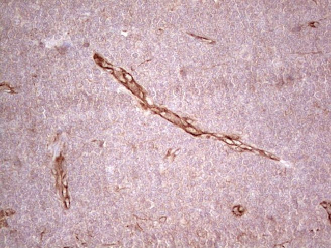 CFI Antibody in Immunohistochemistry (Paraffin) (IHC (P))