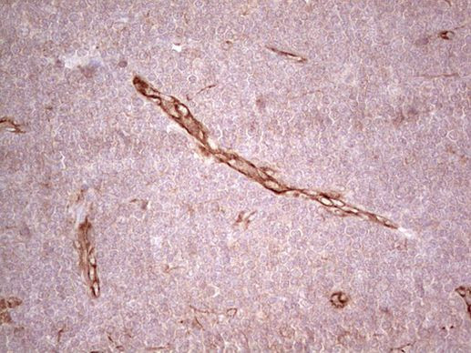 CFI Antibody in Immunohistochemistry (Paraffin) (IHC (P))