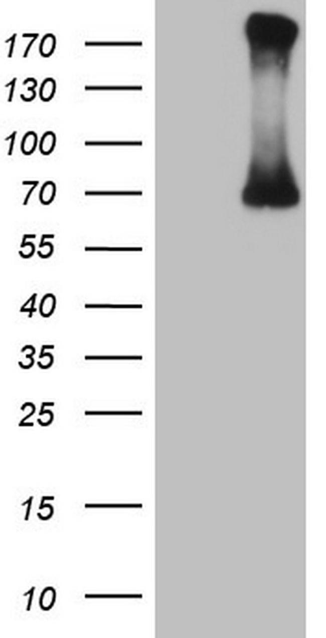 CFI Antibody in Western Blot (WB)