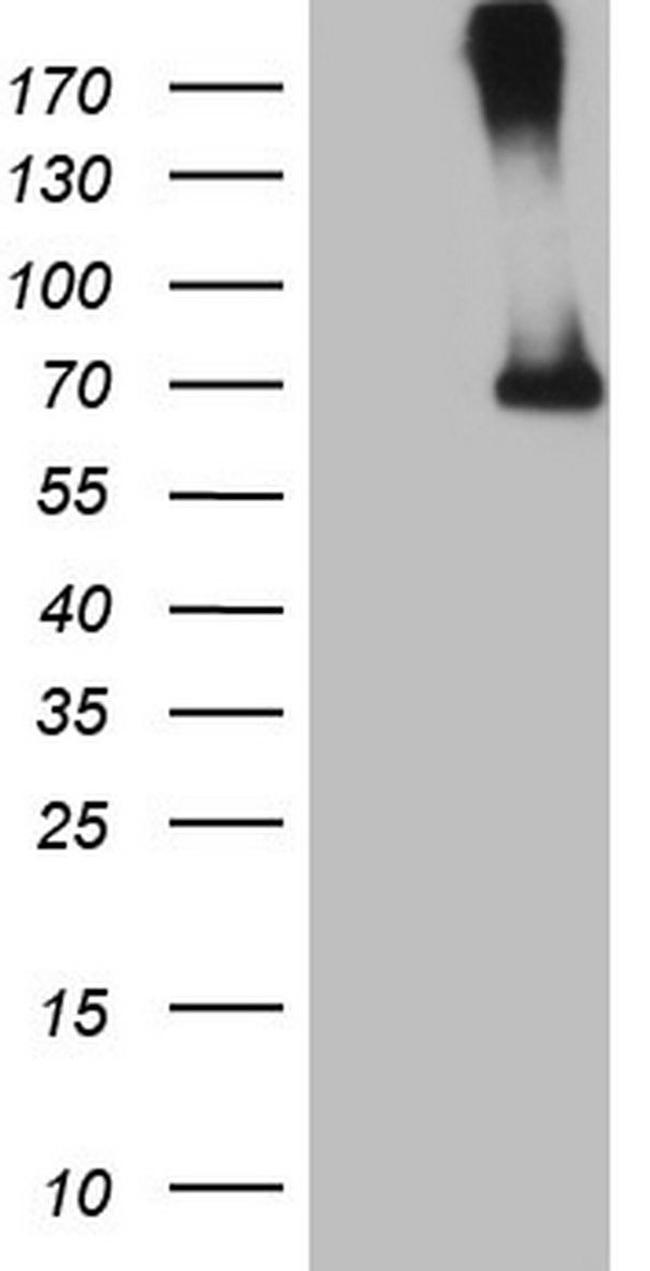 CFI Antibody in Western Blot (WB)