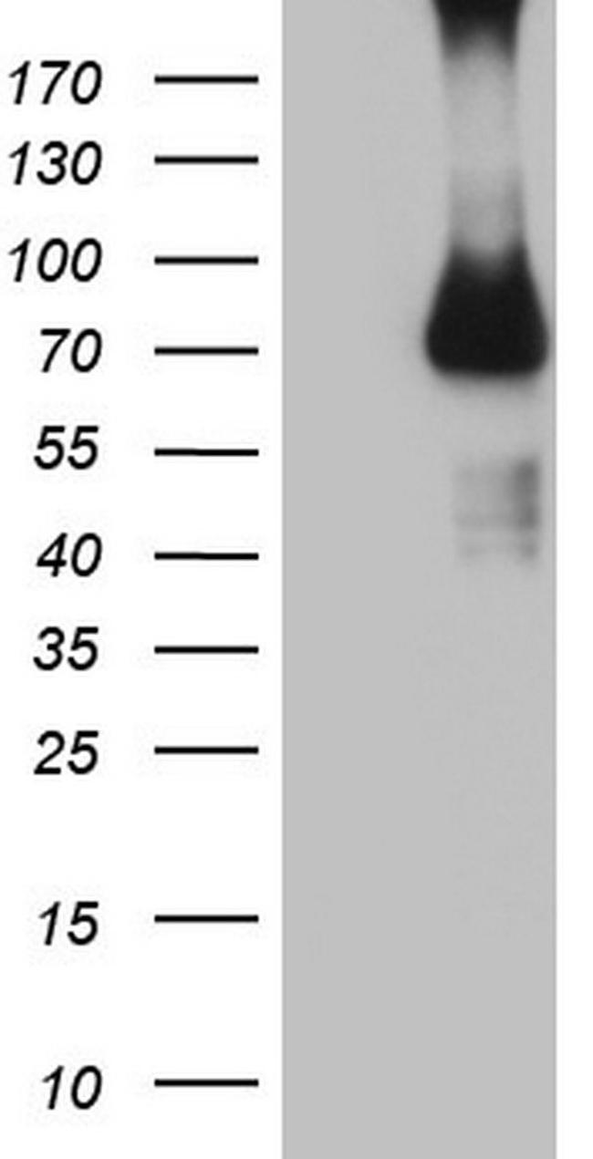 CFI Antibody in Western Blot (WB)