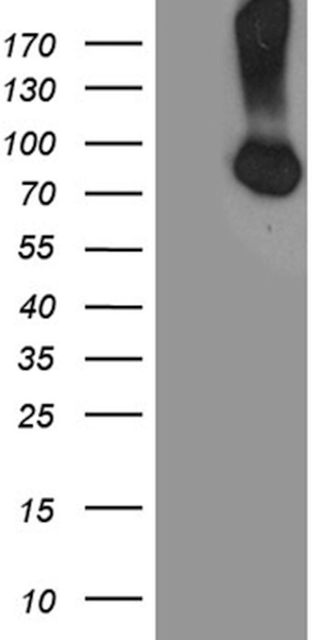 CFI Antibody in Western Blot (WB)