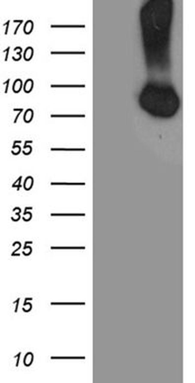 CFI Antibody in Western Blot (WB)