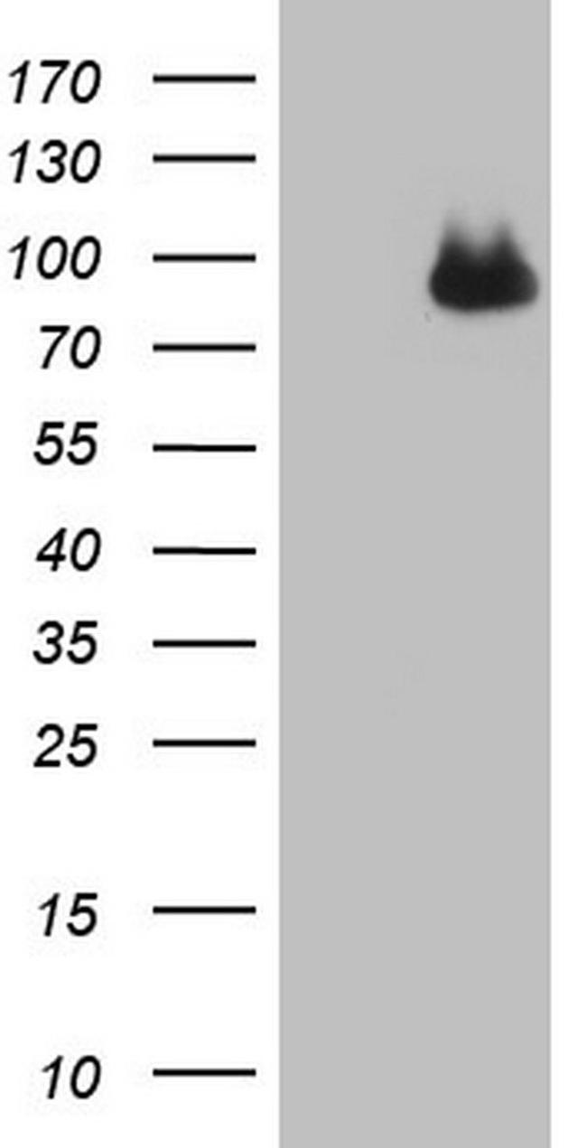 CFI Antibody in Western Blot (WB)