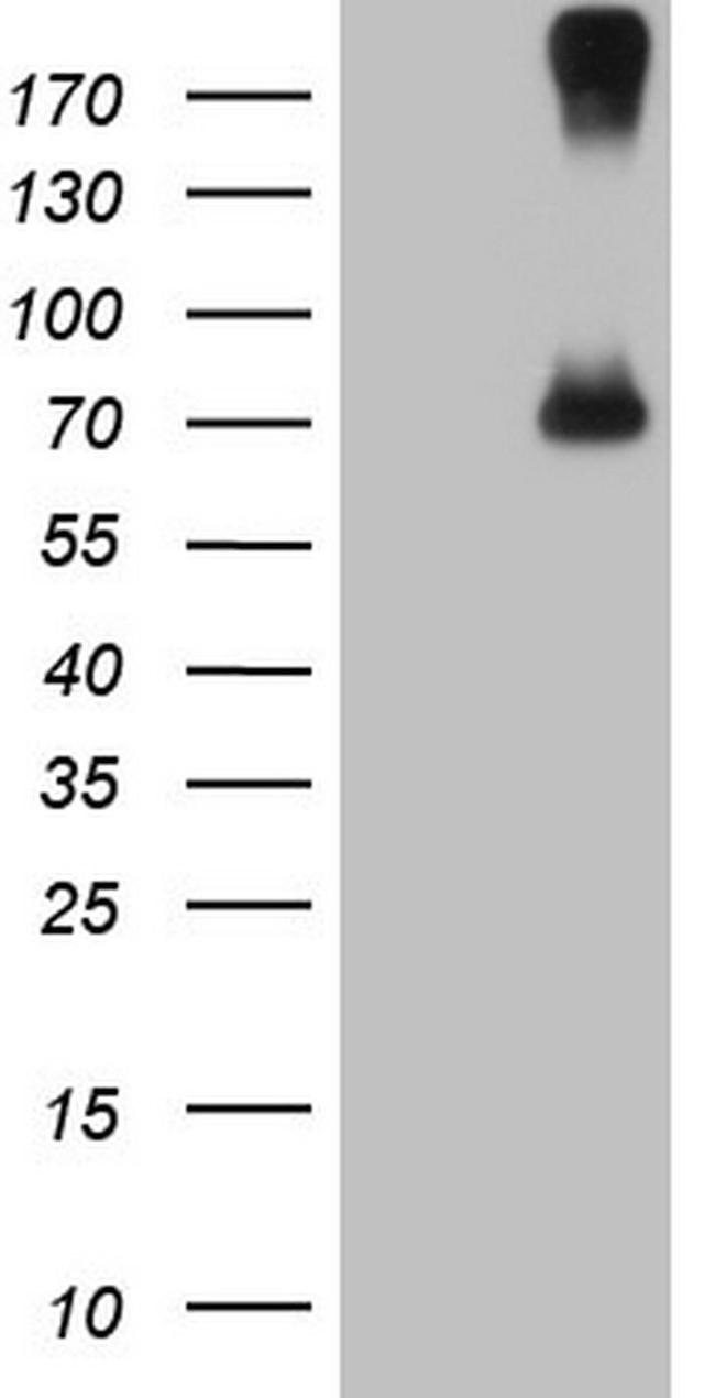 CFI Antibody in Western Blot (WB)