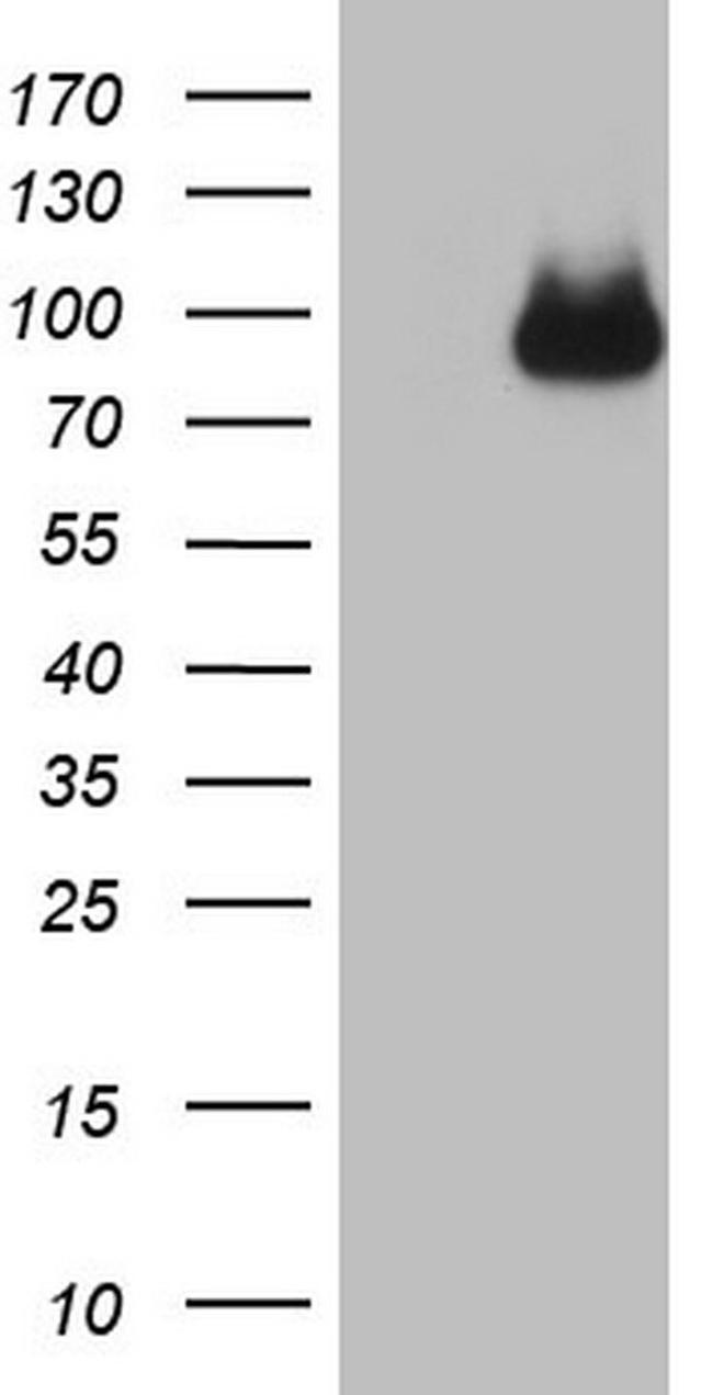 CFI Antibody in Western Blot (WB)