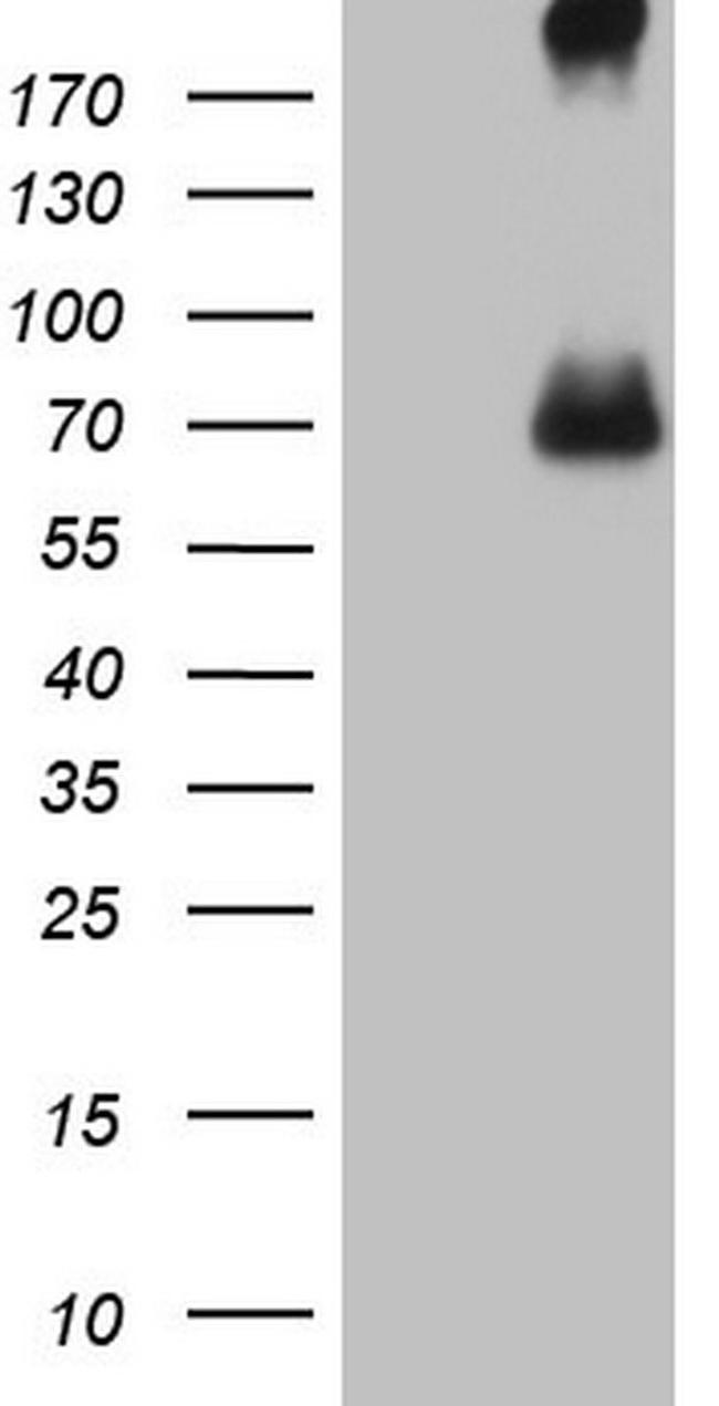 CFI Antibody in Western Blot (WB)