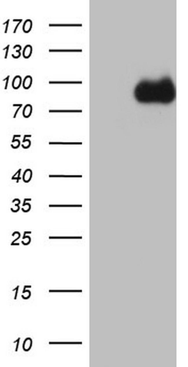 CFI Antibody in Western Blot (WB)