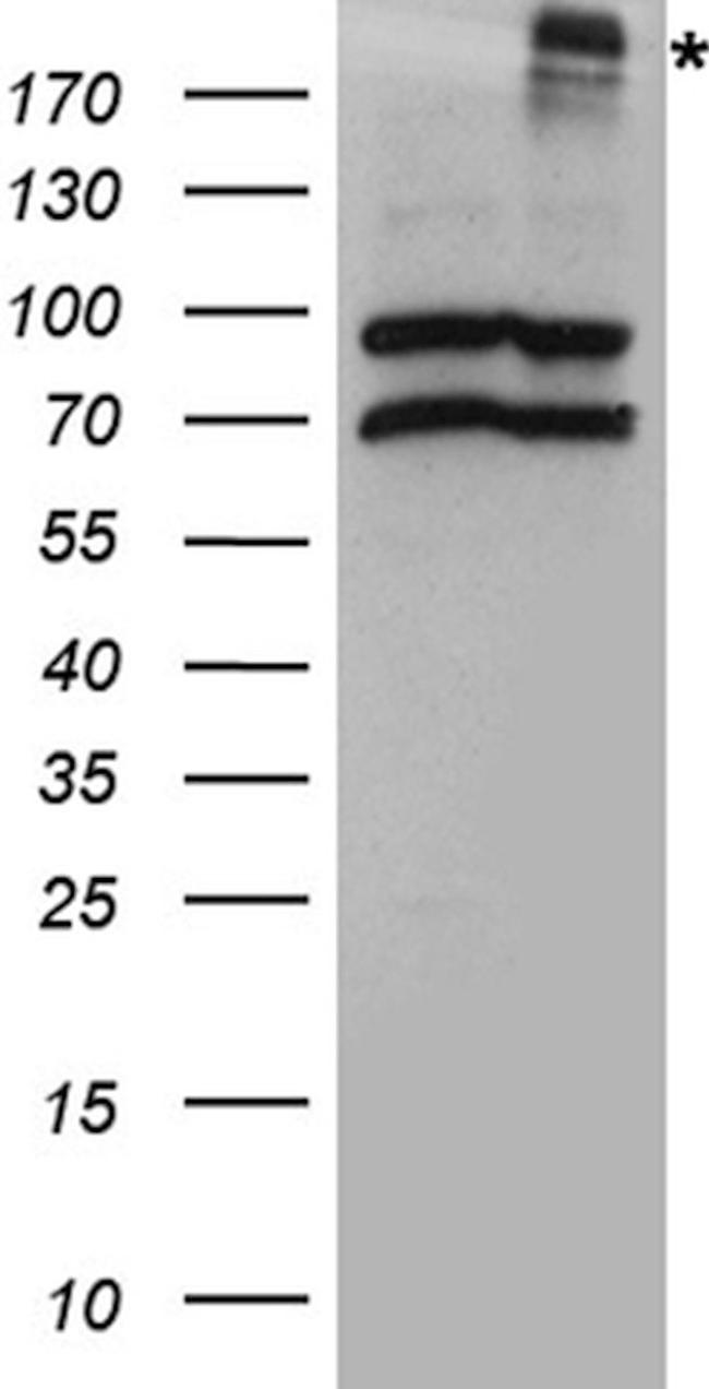 CFTR Antibody in Western Blot (WB)