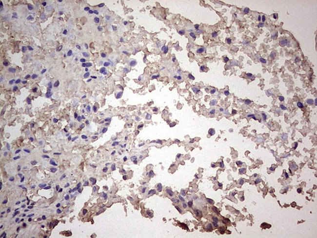 CGB Antibody in Immunohistochemistry (Paraffin) (IHC (P))
