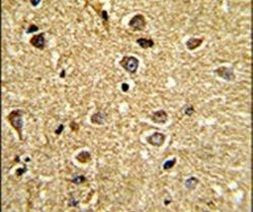RCBTB2 Antibody in Immunohistochemistry (IHC)