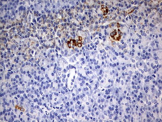 CHCHD3 Antibody in Immunohistochemistry (Paraffin) (IHC (P))