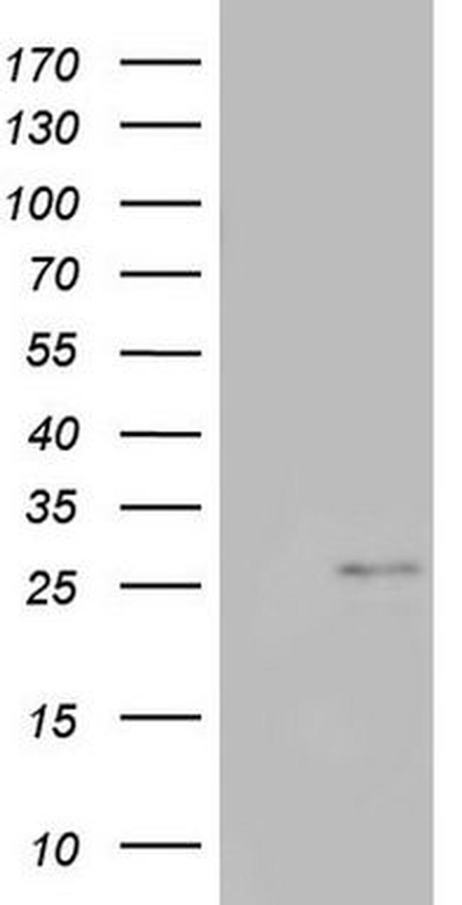 CHCHD3 Antibody in Western Blot (WB)