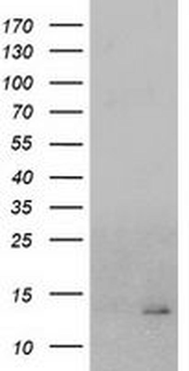 CHCHD5 Antibody in Western Blot (WB)