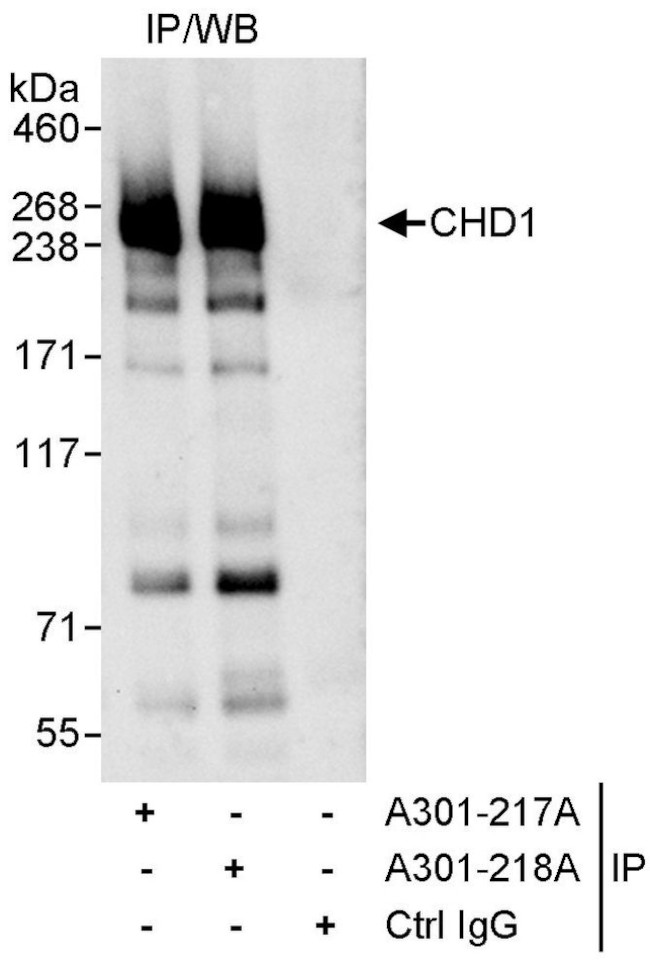 CHD1 Antibody in Immunoprecipitation (IP)