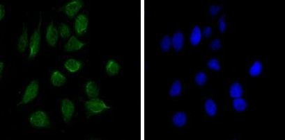 CHD3 Antibody in Immunocytochemistry (ICC/IF)