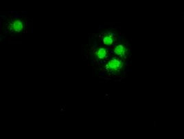 CHEK2 Antibody in Immunocytochemistry (ICC/IF)