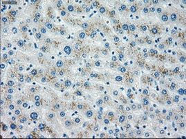 CHEK2 Antibody in Immunohistochemistry (Paraffin) (IHC (P))