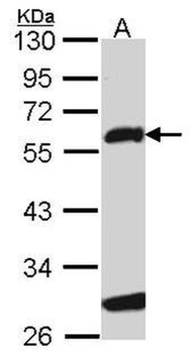 FOXN3 Antibody in Western Blot (WB)