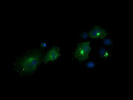 CHGA Antibody in Immunocytochemistry (ICC/IF)