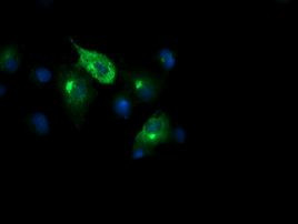 CHGA Antibody in Immunocytochemistry (ICC/IF)