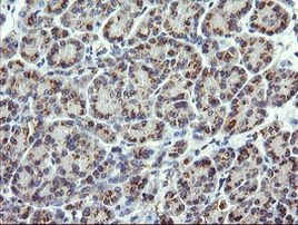 CHGA Antibody in Immunohistochemistry (Paraffin) (IHC (P))