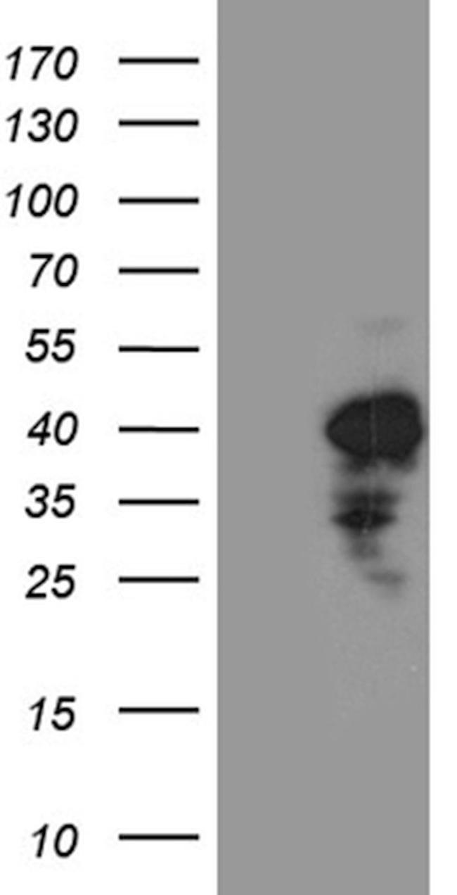 CHIA Antibody in Western Blot (WB)