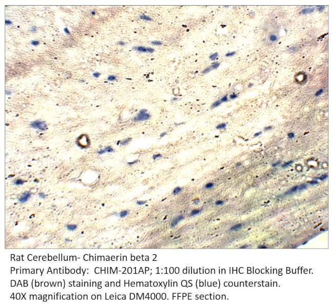 Chimaerin beta 2 Antibody in Immunohistochemistry (IHC)