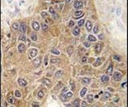 STUB1 Antibody in Immunohistochemistry (IHC)
