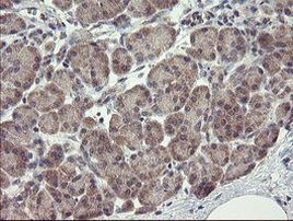 CHN1 Antibody in Immunohistochemistry (Paraffin) (IHC (P))