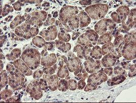 CHN1 Antibody in Immunohistochemistry (Paraffin) (IHC (P))