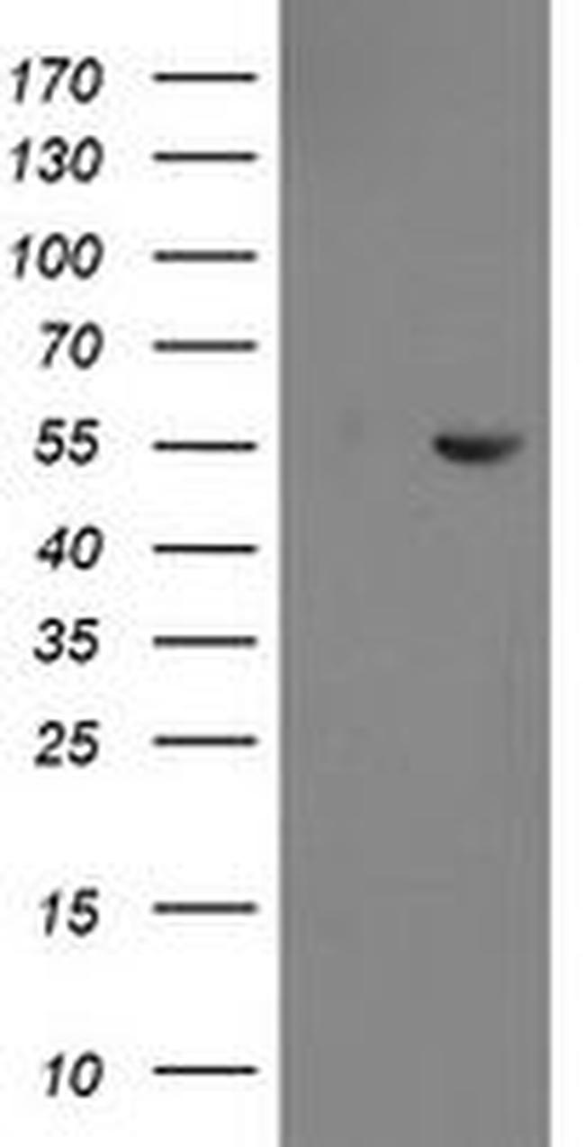 CHN1 Antibody in Western Blot (WB)