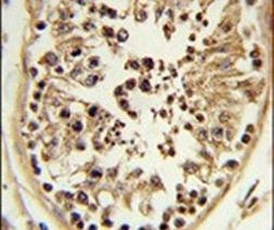 CHPF Antibody in Immunohistochemistry (IHC)