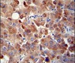 CHRDL1 Antibody in Immunohistochemistry (IHC)