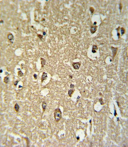CHRNA3 Antibody in Immunohistochemistry (IHC)