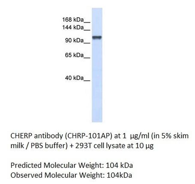 CHERP Antibody in Western Blot (WB)