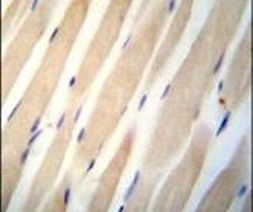 CHST3 Antibody in Immunohistochemistry (IHC)