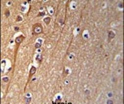 CI091 Antibody in Immunohistochemistry (IHC)