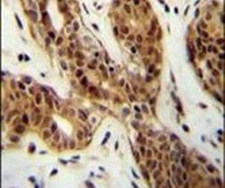 LURAP1L Antibody in Immunohistochemistry (IHC)